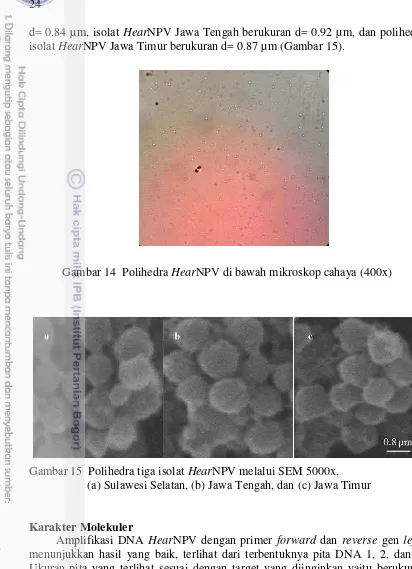 Gambar 14  Polihedra HearNPV di bawah mikroskop cahaya (400x) 