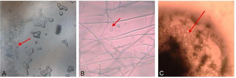 Gambar 6  Imago D. citri yang terinfeksi cendawan entomopatogen, B. bassiana (A), L. lecanii (B) dan M