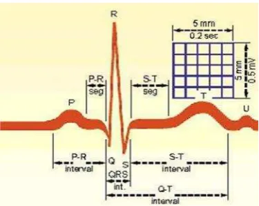 Gambar 12. Sinyal EKG Normal (Lutfianto dkk, 2011).