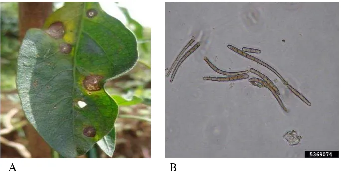 Gambar 1. (A) Gejala bercak daun Cercosporadan (B) Konidia Cercospora capsici. 