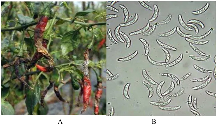 Gambar 2. (A) Gejala antraknosa cabai dan (B) Konidia Collectrotichum capsici. 