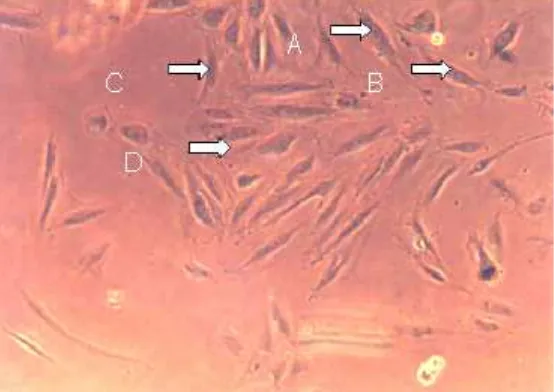Gambar 1. Morfologi Sel Endotel Vena Umbilikalis ManusiaPrimer Normal Hari Ke-4 kultur, diambil dengan Mikroskop Inverted