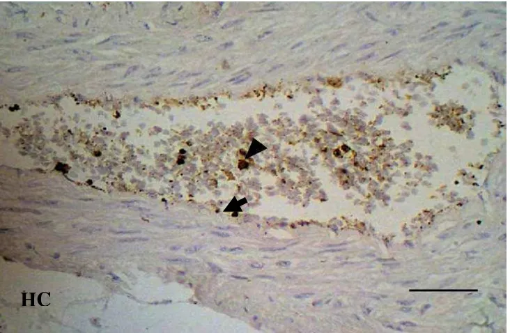Gambar 41. Distribusi antigen hog cholera di sel leukosit dalam pembuluh darah (tanda kepala anak panah) dan sel endotel buluh darah organ jantung (tanda anak panah)