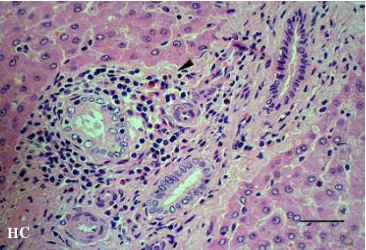 Gambar 42.  Infiltrasi sel radang pada septum interlobularis hati (tanda kepala anak panah)