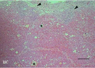 Gambar 44.  Sel radang dalam buluh darah sinusoid (tanda asterik) dan di sekitar fokus nekrosa hepatosit (tanda kepala anak panah)