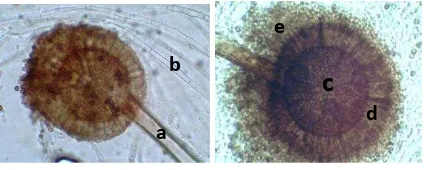 Gambar 1. Gambar Mikroskopis jamur Aspergillus sp. dengan pembesaran 400 kali Keterangan : a