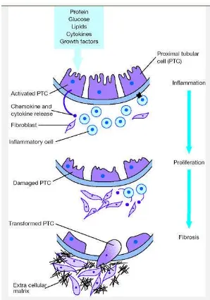 Gambar 3 Patomekanisme terjadinya parut tubulointerstisial