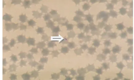 Gambar 3  Theileria sp. di dalam sel darah merah. 