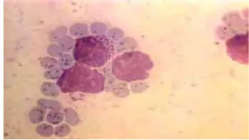 Gambar 1  Skizon di dalam limfosit dan piroplasma di dalam eritrosit.  