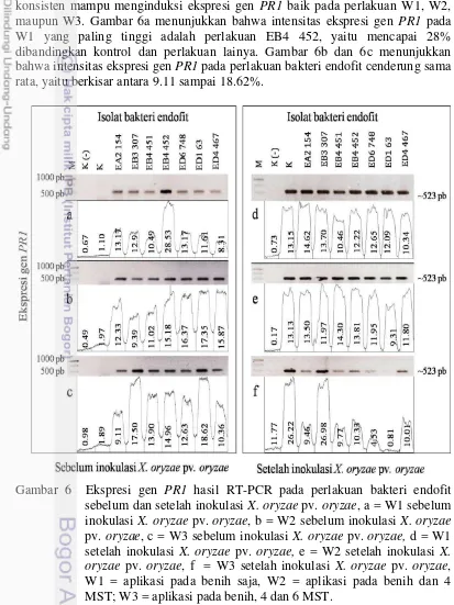 Gambar 6  Ekspresi gen PR1 hasil RT-PCR pada perlakuan bakteri endofit 