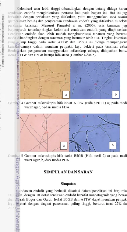 Gambar 4 Gambar mikroskopis hifa isolat A1TW (Hifa steril 1) a) pada media 