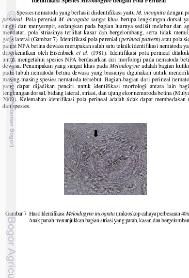 Gambar 7  Hasil Identifikasi Meloidogyne incognita (mikroskop cahaya perbesaran 40x).     