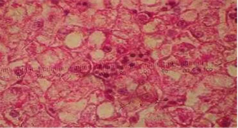 Gambar 2. Histologi hati ikan lele (Clarias sp) yang diberi perlakuan A(0) 