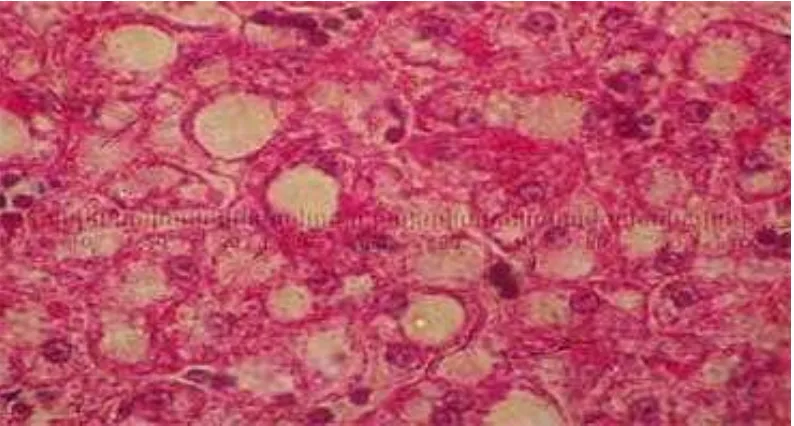 Gambar 4. Histologi hati ikan lele (Clarias sp) yang diberi perlakuan C(12) 