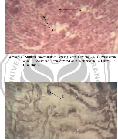 Gambar 4. Struktur mikroanatomi insang ikan bandeng (A1). Perbesaran