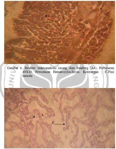 Gambar 6. Struktur mikroanatomi insang ikan bandeng (A3). Perbesaran