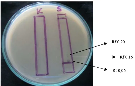 Gambar 1. Hasil uji bioautografi ekstrak aseton kulit buah kakao terhadap bakteri                        S