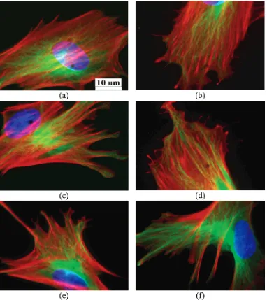 Figure 9. Fluorescent F-actin (red) and clathrin (green) images of (a and b) control cells after 6 and 24 h culture, (c and d) cellsincubated with LAA-coated SPION, and (e and f) cells incubated with BSA-APTMS-coated SPION, respectively.
