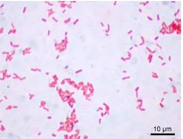 Gambar 1  Escherichia coli. Pewarnaan Gram.                                                     Sumber: Todar (2008a) 
