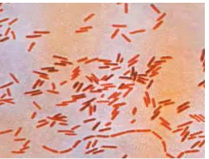 Gambar 3  Salmonella. Pewarnaan Gram.                                             Sumber: Todar (2008) 
