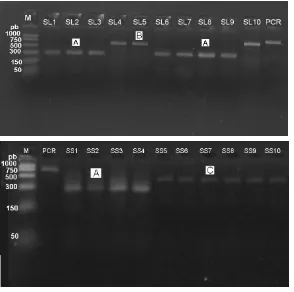 Gambar 8. Digesti mtDNA dengan NlaIV (empat tipe restriksi: A, B, C, D) Ket: M: marker, PCR: DNA amplifikasi, pb: pasangan basa, BL: Belitung 