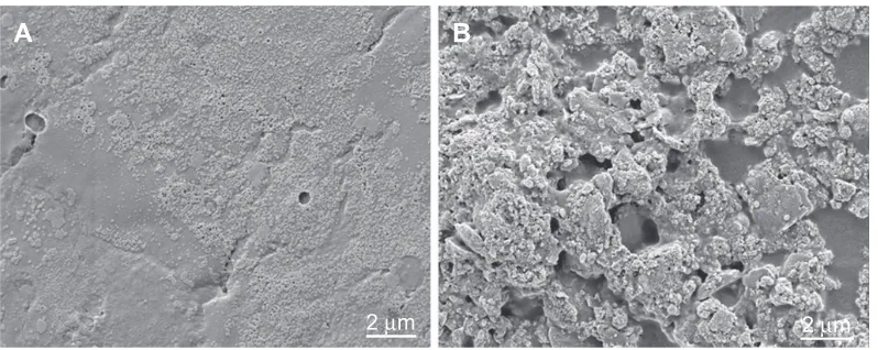 Figure 7 Evaluation of FBSA attachment on the RWM of guinea pigs.Note: seM images reveal the adherent difference between the BSA NPs (A) and FBSA (B).Abbreviations: FBsa, lower-shaped bovine serum albumin; RWM, round-window membrane; NPs, nanoparticles; SEM, scanning electron microscopy.