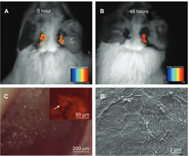 Figure 8 Images taken at different time points after FBSA-RhB was injected into the bullae of guinea pigs.Abbreviations: (further revealed the obvious deposition of RhB (Notes: FBSA-RhB was retained in the bullae longer than the BSA-RhB NPs (A, B), viewed 