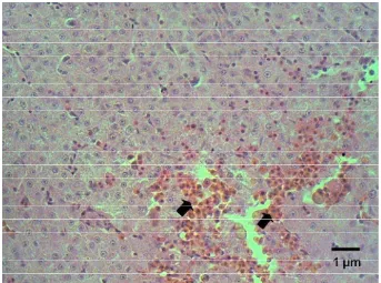Gambar 33. Kongesti dan dilatasi sinusoid hati pada ikan lele jam ke-2 pi E. ictaluri (tanda panah), Pewarnaan HE, skala1µm  