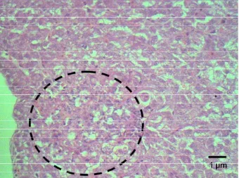 Gambar 36. Nekrosis multifokal pada jaringan hati ikan lele disertai infiltrasi sel radang limfosit dan makrofag pada jam ke 36 pi E