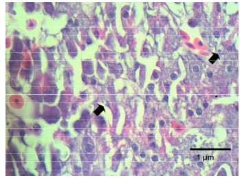 Gambar 39. Daerah nekrosa sel asinar pankreas ikan lele  pada jam ke 72 pi E. ictaluri (tanda panah), Pewarnaan HE, skala1µm  