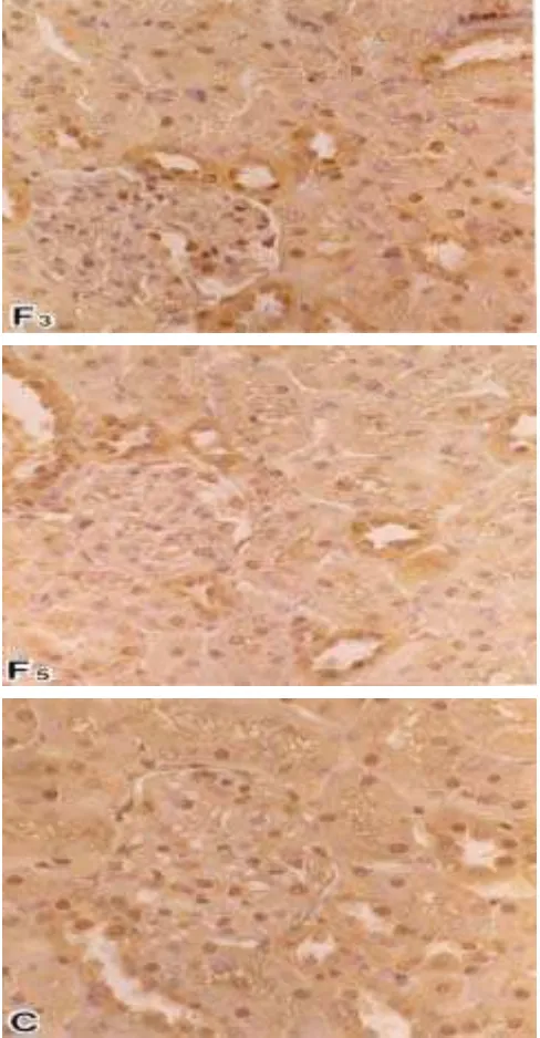 Table 3. The number of renal tubule cells in different degree of reactionproduct to Cu,Zn-SOD in the male Wistar rats under stresscondition, per view of 400 magnification