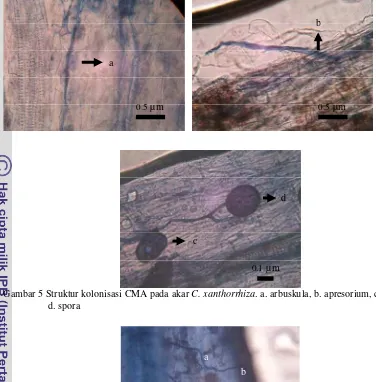 Gambar 5 Struktur kolonisasi CMA pada akar  C. xanthorrhiza. a. arbuskula, b. apresorium, c