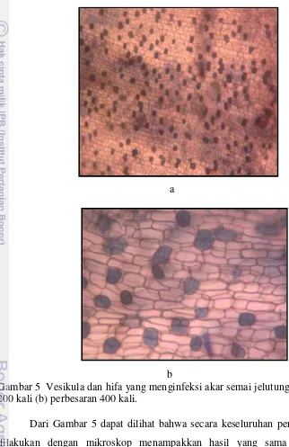 Gambar 5  Vesikula dan hifa yang menginfeksi akar semai jelutung (a) perbesaran 