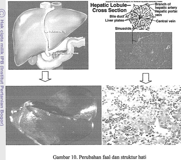 Gambar  10.  Perubahan faal dan struktur hati 