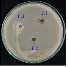 Gambar 3. Hasil elusi KLT (A) deteksi visual, (B) deteksi UV 254 nm, (C) deteksi UV 366 nm,     