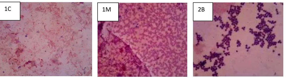 Gambar 1. Hasil Pengecatan Gram Isolat rare Actinomycetes 1C, 1M, dan 2B 