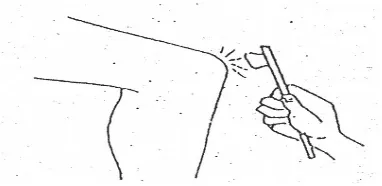 16.GambarPemeriksaan reflek lutut (patella)
