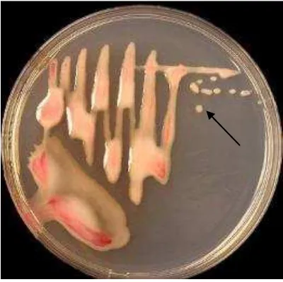 Gambar 4. Koloni Ralstonia sp. berlendir berwarna merah muda pada media TZC (Triphenyl Tetrazolium Chlorida) (Sumber: http://laporanbakteri.blogspot.co.id) 