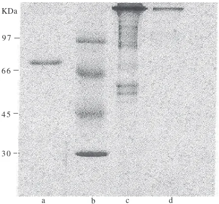 Fig 2  Protein bands of chicken serum after ammonium