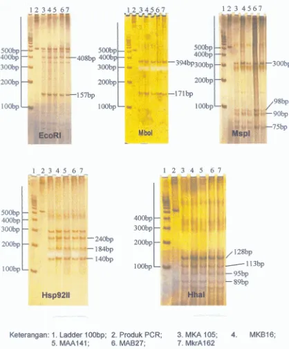 Gambar 4. Hasll pemotongan EooRI, Mbol, Hhal, Hsp9211 dan Mspi terhadap produk PCR sample P