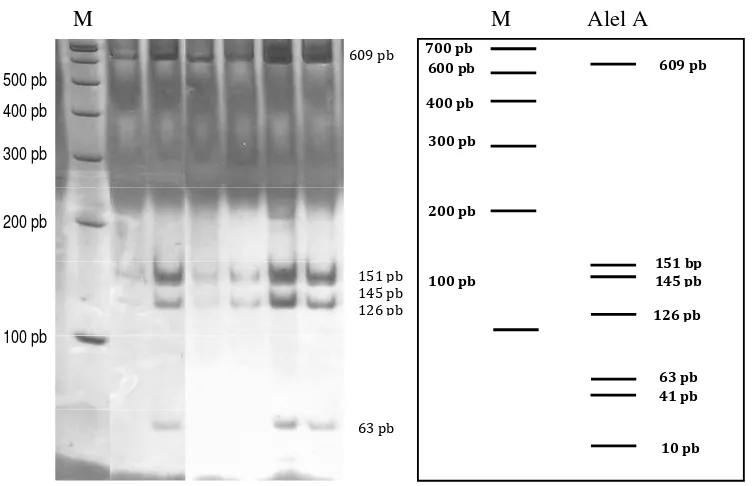 Gambar 6.  Pola Migrasi PCR-RFLP Menggunakan Enzim AluI. A= 423, 356, 182, 84, 57 dan  43 pb