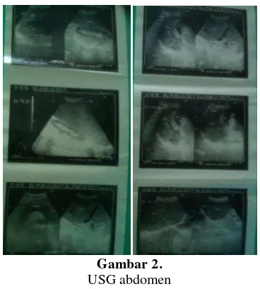 Gambar 1. Pada pemeriksaan imaging x-ray thorax dan BoF a. Foto thoraks; b. Foto BoF tidak ditemukan kelainan