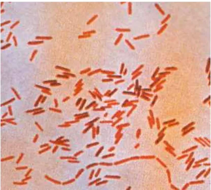 Gambar 2  Bakteri Salmonella typhi dengan pewarnaan gram. 
