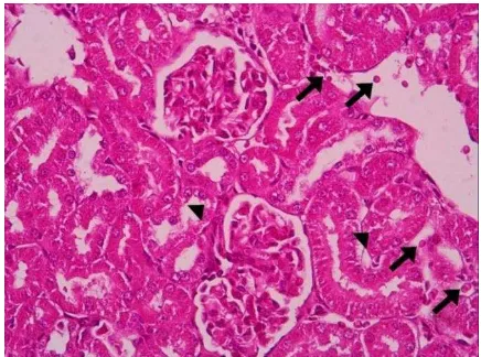 Gambar 5. Kelompok 2. Pewarnaan HE. Perbesaran 400x. 