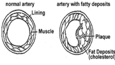 Gambar 6. Proses pembentukan plak 