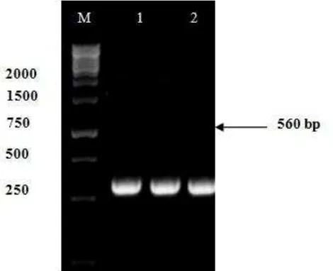 Figure 2. Microscopic characteristics of Fusarium sp. isolate w1 (A) macro conidia (B) septated hypae (C)Chlamydospore