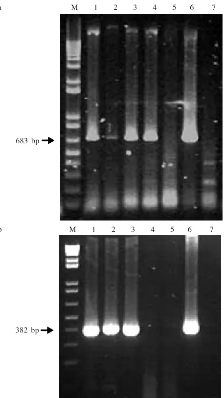 Figure 2. RT-PCR detection of Bean common mosaic virus with CIRevand CIFor primers (a); and Cucumber mosaic virus CMV 1Fand CMV 1R (b)