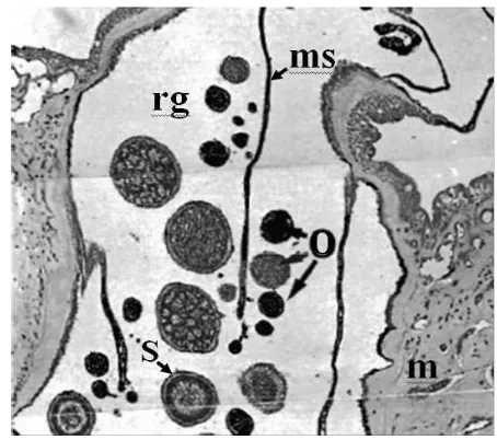 Gambar 5. Hasil potongan histologis polip karang lunak Heteroxenia fuscescens (Achituv dan Benayahu, 1990)