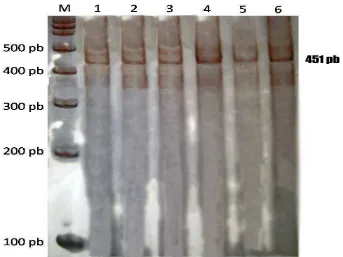 Gambar 1.  Hasil Amplifikasi Gen GHRH Menggunakan Metode PCR pada Gel Poliakrilamida 6% 