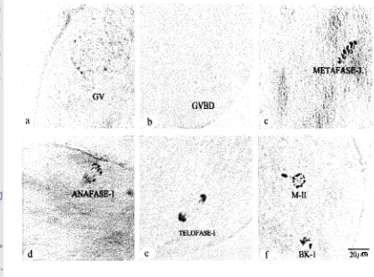 Gambar 5. Perkembangan status inti oosit domba selama pematangan in vitro. (a) Tahap Germrnal Vesicle (GV), (b)